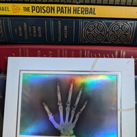 X-Ray Hand Specimen Art Print - Thumbnail 1